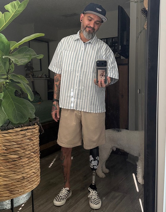 A man with a prosthetic leg takes a selfie in his home wearing Checkerboard Authentic, knee-length tan shorts, and a striped shirt.